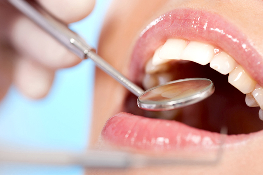 歯周病・歯肉炎について