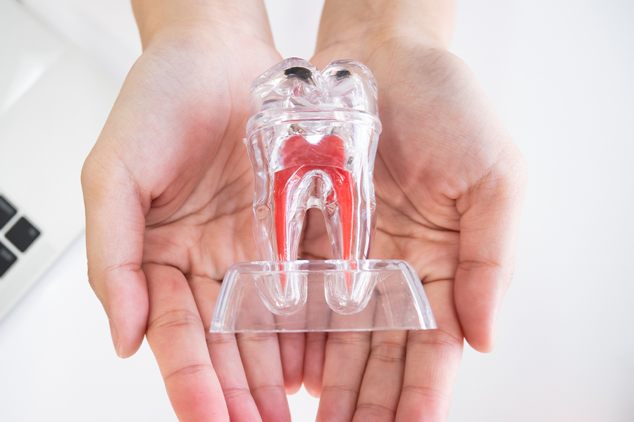 歯髄保存療法について