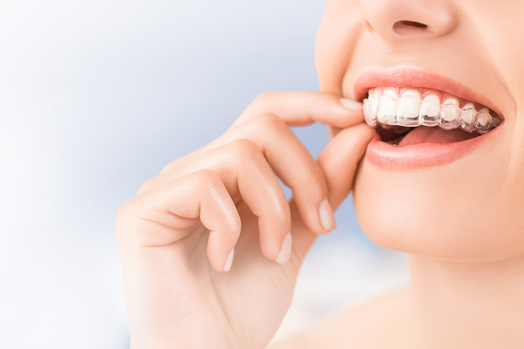 ホームホワイトニングについて