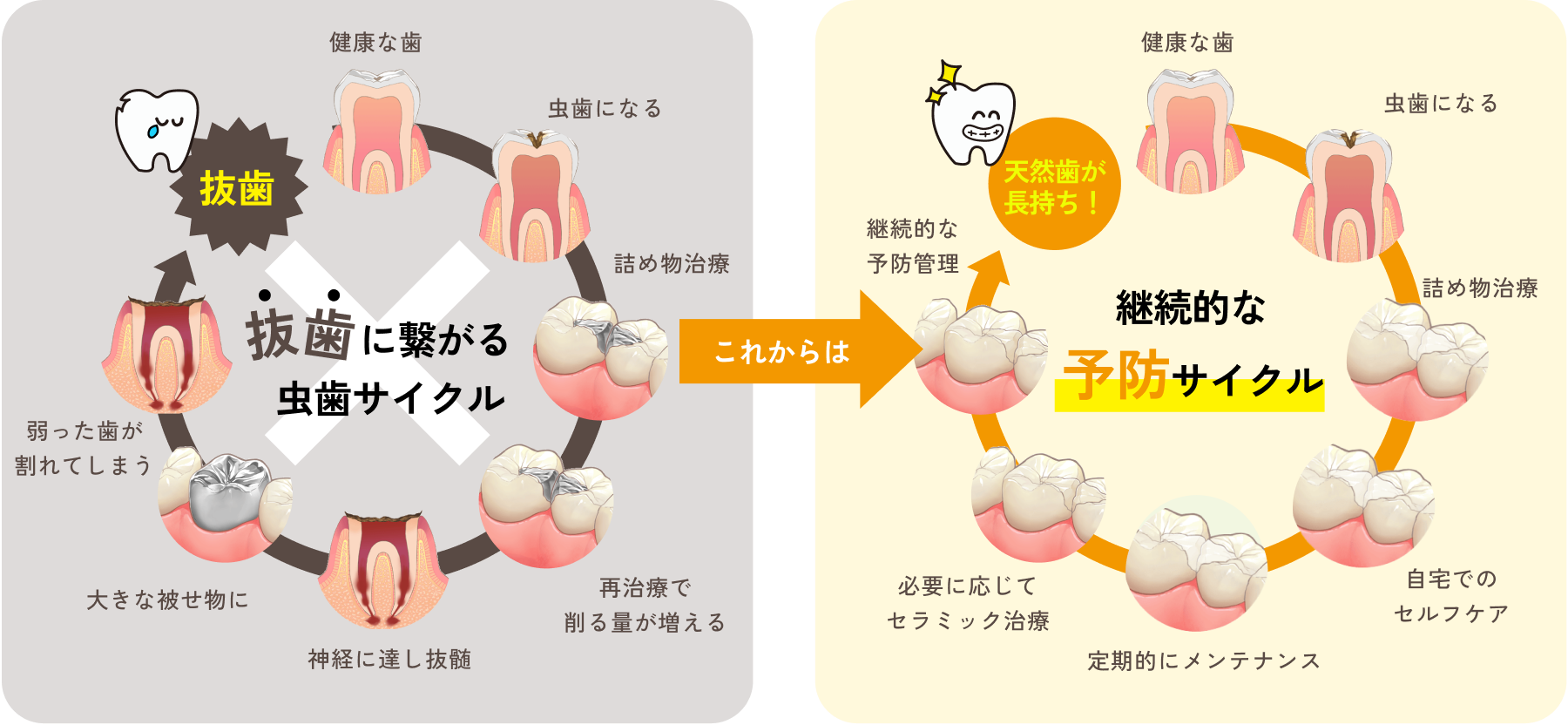 虫歯の予防法について